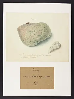 Portion: Interlobular Emphysema and Dried Lung