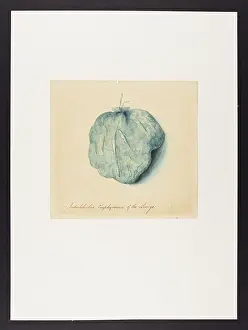 Lungs: Interlobular Emphysema of the Lungs