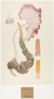 Tubercle: Intestine. Tubercle. (Unnumbered Drawing)