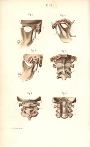 Corbie: Jaw bone and neck