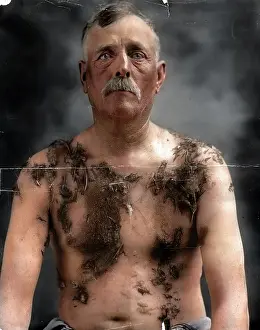 Tarred: John Meintz, tarred and feathered in public