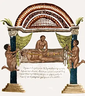 Reduction: Joint Dislocation Treatment, 1st Century BC