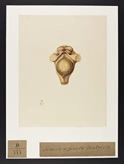 Brain: Large Round Tubercle: Fourth Ventricle of the Brain