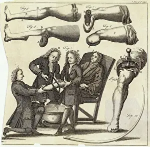 Amputating: Leg amputation