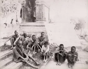 Leprosy: Lepers, suffers of Leprosy, Rangoon, Yangon, Burma