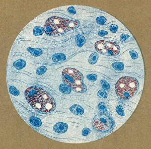 Bacillus: LEPROSY BACILLUS