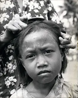 Educate: Leprosy in Indonesia