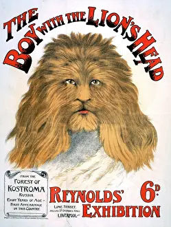 Oddities: Lion headed boy