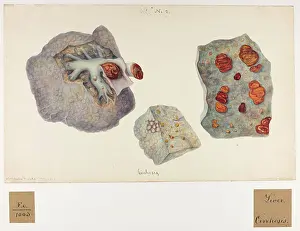 Liver: Liver: Cirrhosis