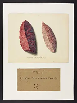 Lungs: Lungs: Tubercle and Pneumonia