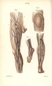 Lymphatic: Lymphatic system in the leg and foot