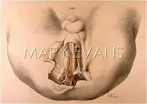 MALE PERINAEUM/1867