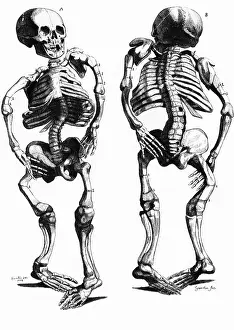 Deformed: Malformed Skeletons