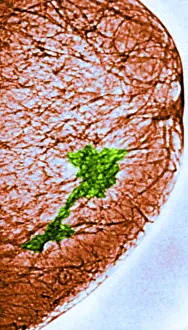 Tumor: Mammogram