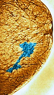 Tumor: Mammogram