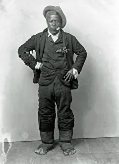 Man with Elephantiasis, West Indies