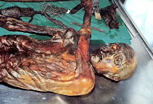Mummies: The man from the ice Otzi