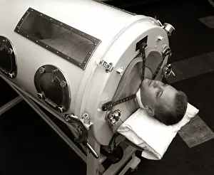 Poliomyelitis: Man lying in iron lung negative pressure ventilator