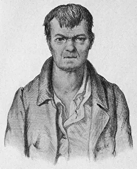 Generally: Man with mental disability and goitre