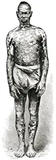 Loango: Man - Mottled - Africa