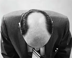Baldness: Top Of Man'S Head From Above Can