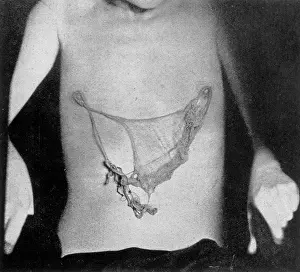Loops: MARTHE BERAUD