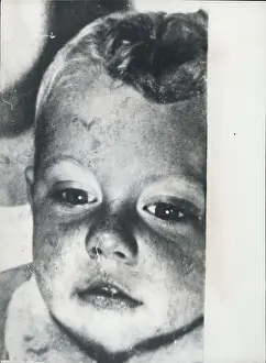 Strangling: The Mary Bell Murder Case