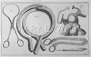 Mastectomy: MASTECTOMY