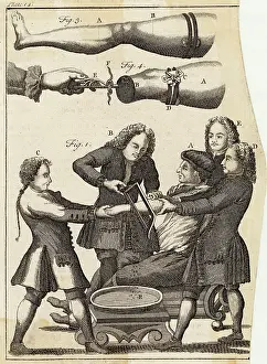 1739: MEDICAL/AMPUTATION/ARM