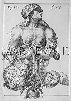 Punctured: MEDICAL/SURGERY C17