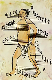 Acupuncture: medicine, acupuncture, plate with acupuncture