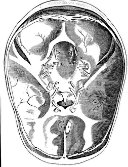 Neurology: medicine, anatomy, brain, base of the skull with