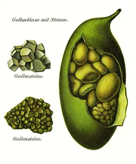 Anatomic: medicine, anatomy, organs, gall bladder, lithograph