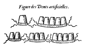 Prosthesis: medicine, dentistry, prostheses, made by Pierre