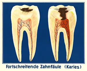 Hygienics: medicine, dentistry, tooth decay, school chart