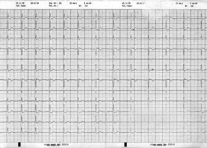 Electrocardiogram: Medicine, examination