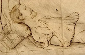 Fracture: medicine, sick persons, man with arm sling, first