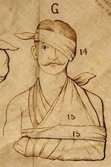 Fracture: medicine, sick persons, man with blindfold, first
