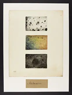 Blank: Melanosis