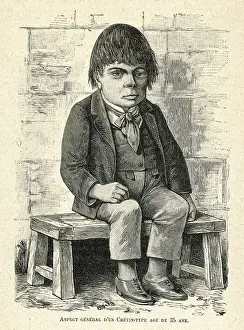 Deficient: Mentally deficient man - aged 35