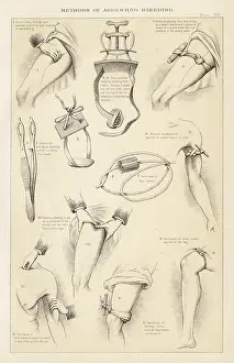 Knotted: Methods of Arresting Bleeding with various tourniquets