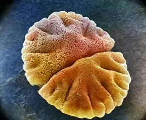Photo Researchers: Micrasterias angulosa, Algae, SEM