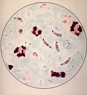 Parasites: Microscopic view of a malaria parasite painted ?