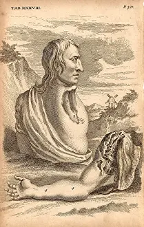 Enough: The miller Samuel Wood, whose arm and scapula