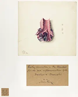 Bronchial: Monkey Bronchial Glands and Trachea
