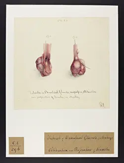 Plantes: Monkey: Tubercles in Bronchial Glands
