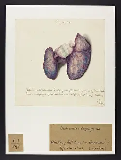 Plantes: Monkey: Tubercular Emphysema and Atrophy of Lung