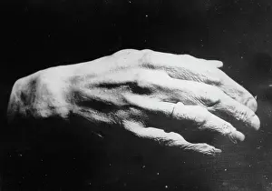 Assasinated: Mould of king Alexander?s hand