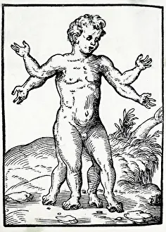 Oddities: MULTI-LIMBED CHILD/1560
