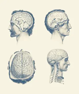 Showcasing: Multiple views of a male's brain, showing the